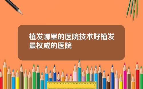 植发哪里的医院技术好植发最权威的医院